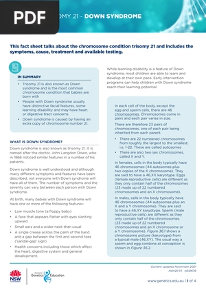 Trisomy 21 - Down Syndrome (Article)