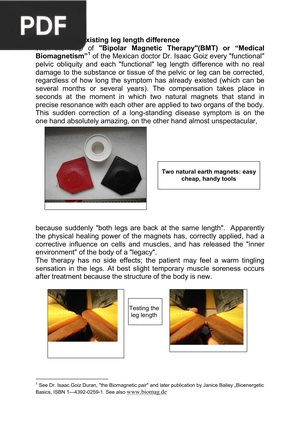 Removing an Existing Leg Length Difference