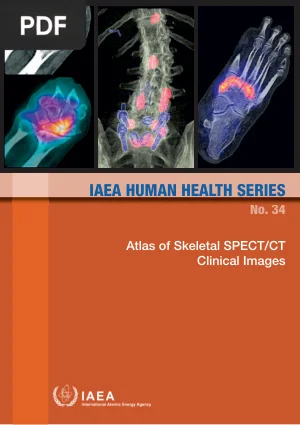Atlas of Skeletal SPECT/CT Clinical Images