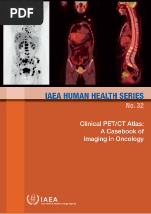 Clinical PET/CT Atlas: A Casebook of Imaging in Oncology