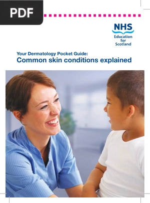 Common Skin Conditions Explained