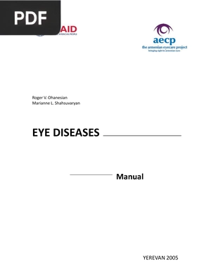 Eye diseases