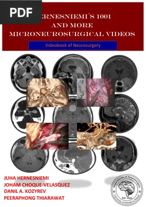 Hernesniemi´s 1001 and more microneurosurgical videos