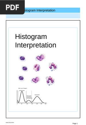 Histogram Interpretation