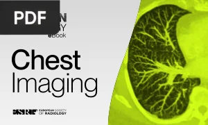 Modern Radiology eBook: Chest Imaging