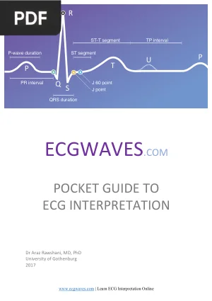 Pocket Guide to ECG Interpretation