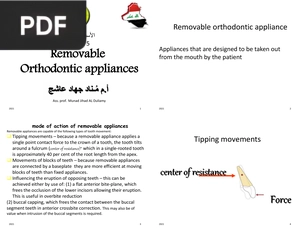Removable Orthodontic Appliances