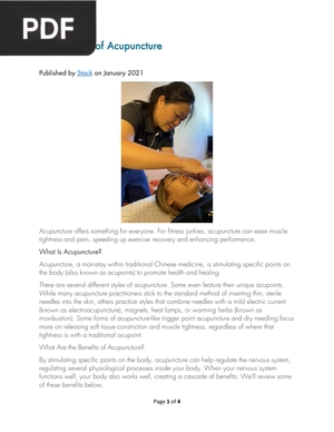 The Benefits of Acupuncture